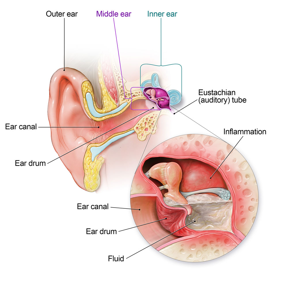 ear-infection-prescription-online-doctor